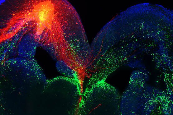 une cure pour soigner l autisme 7