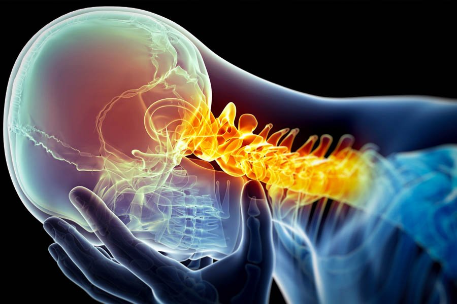 le cannabis contre les maux de tête 3