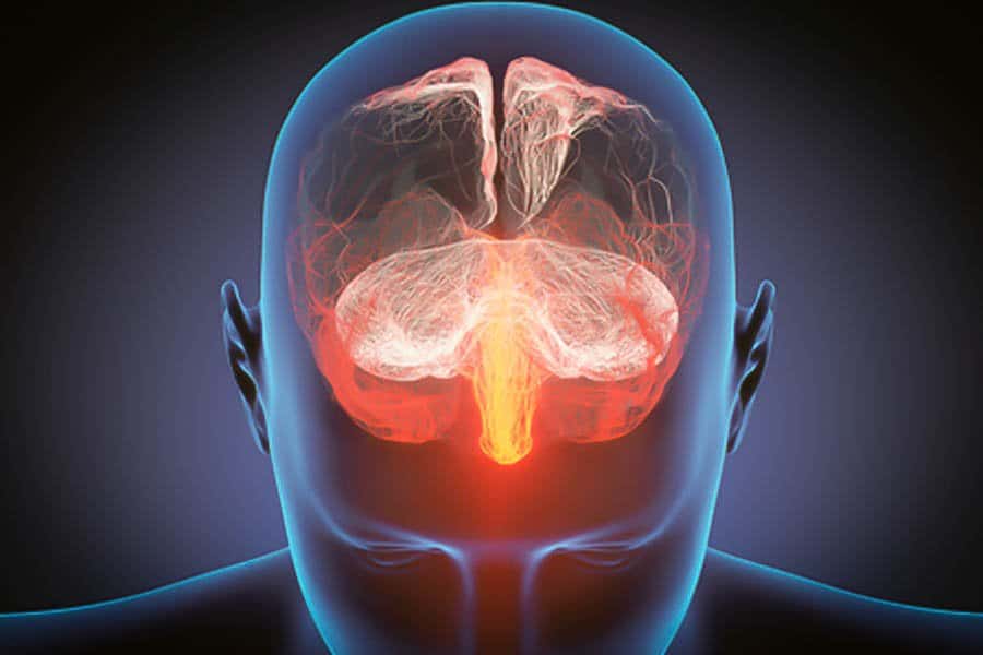 cannabis vs sclérose en plaques 7