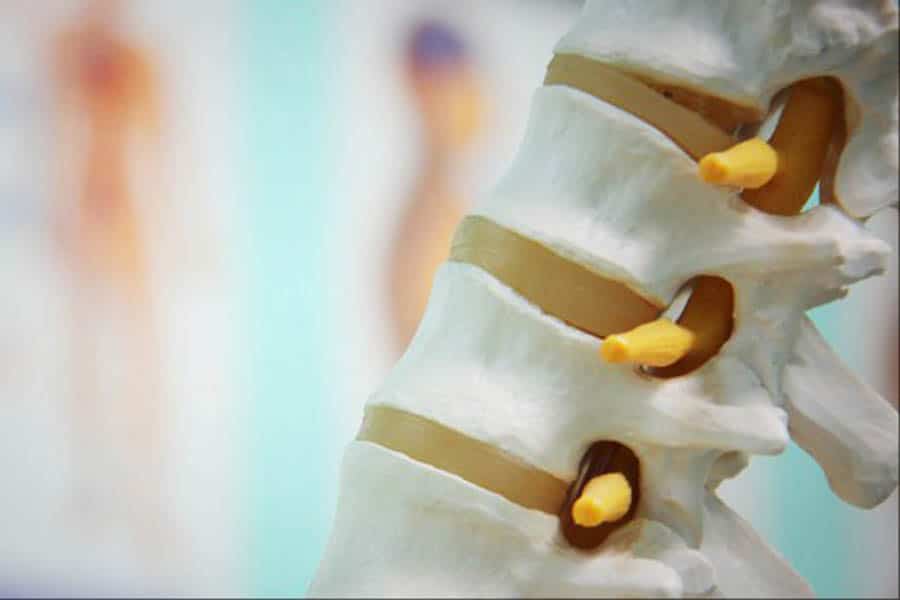 le cannabis lors d un traumatisme médullaire 5