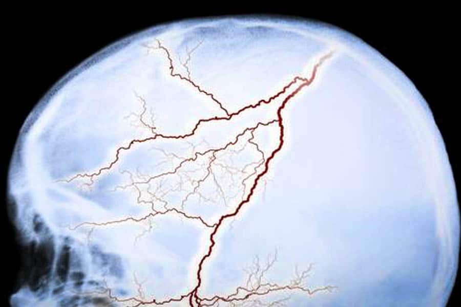 le cannabis ne crée pas de lésions cérébrales 5