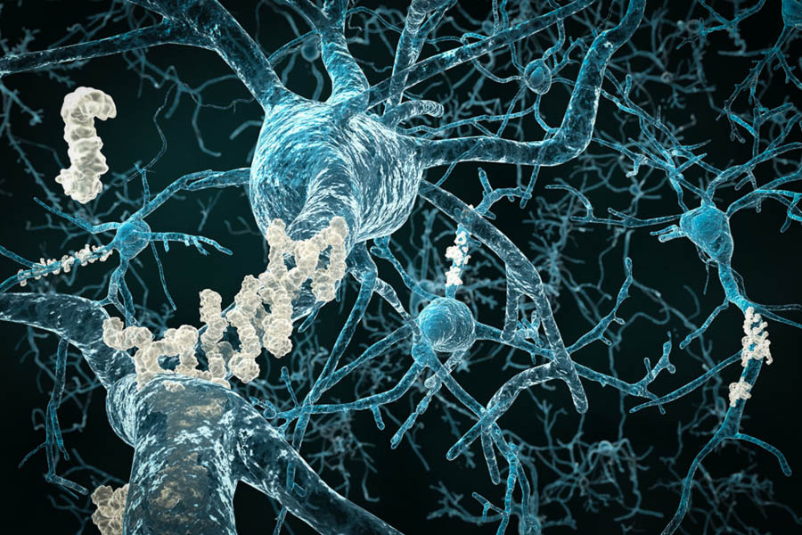 thc confirmé contre la maladie d alzheimer 5