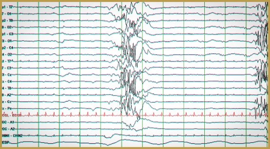 une fillette sauvée par le thc 2