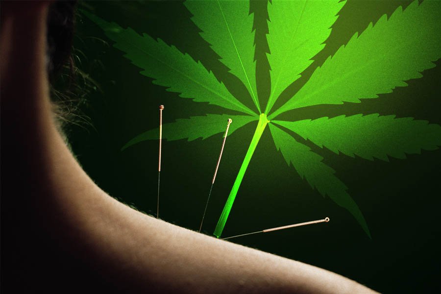 le cannabis l’acupuncture 9