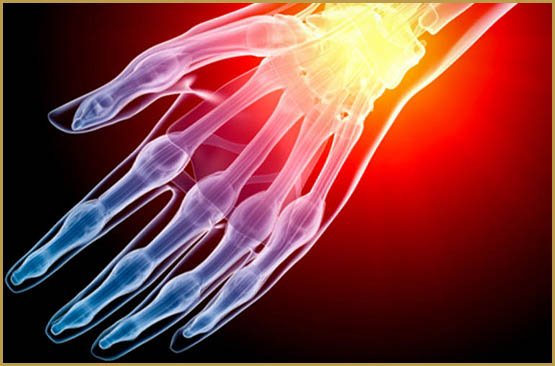 syndrome_douloureux_gallerylarge