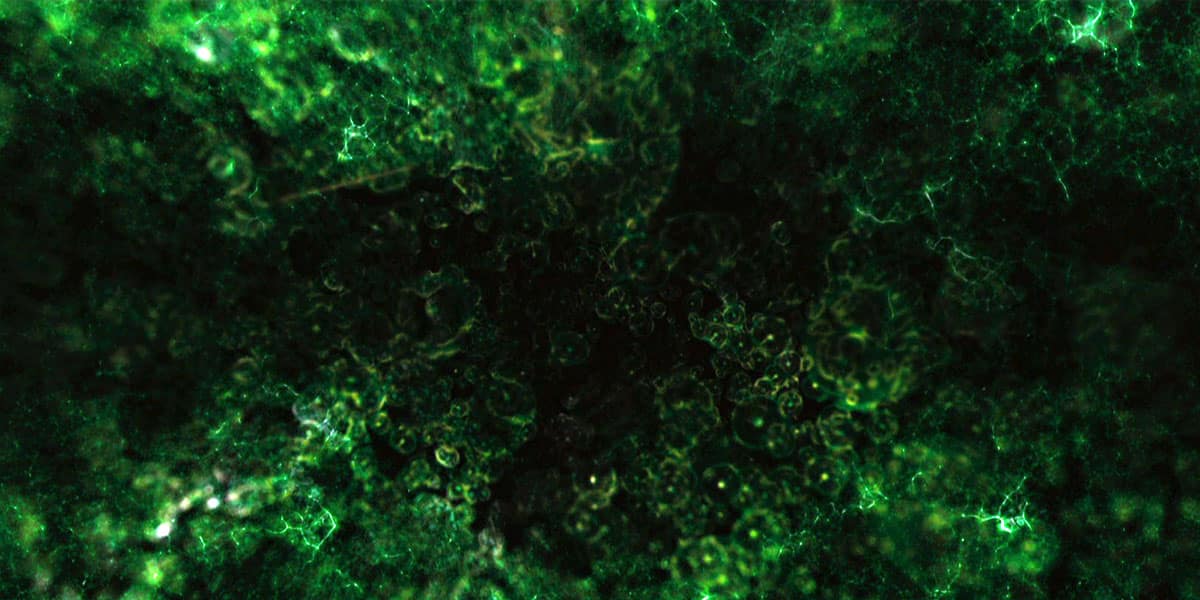 l irradiation gamma 7