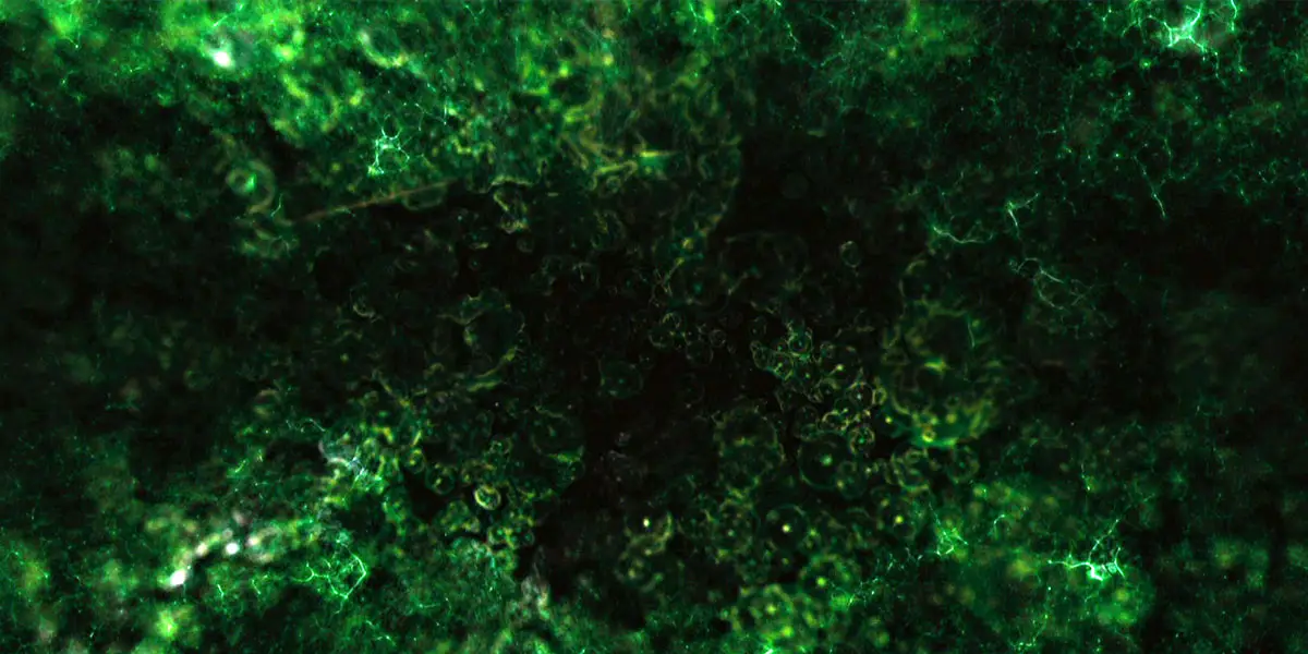 l irradiation gamma 7