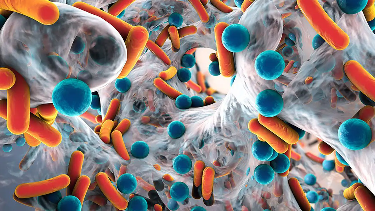la resistance aux antibiotiques un defi mondial